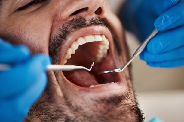 Best 24-Hour Emergency Dental Care in Bunker Hl, IL